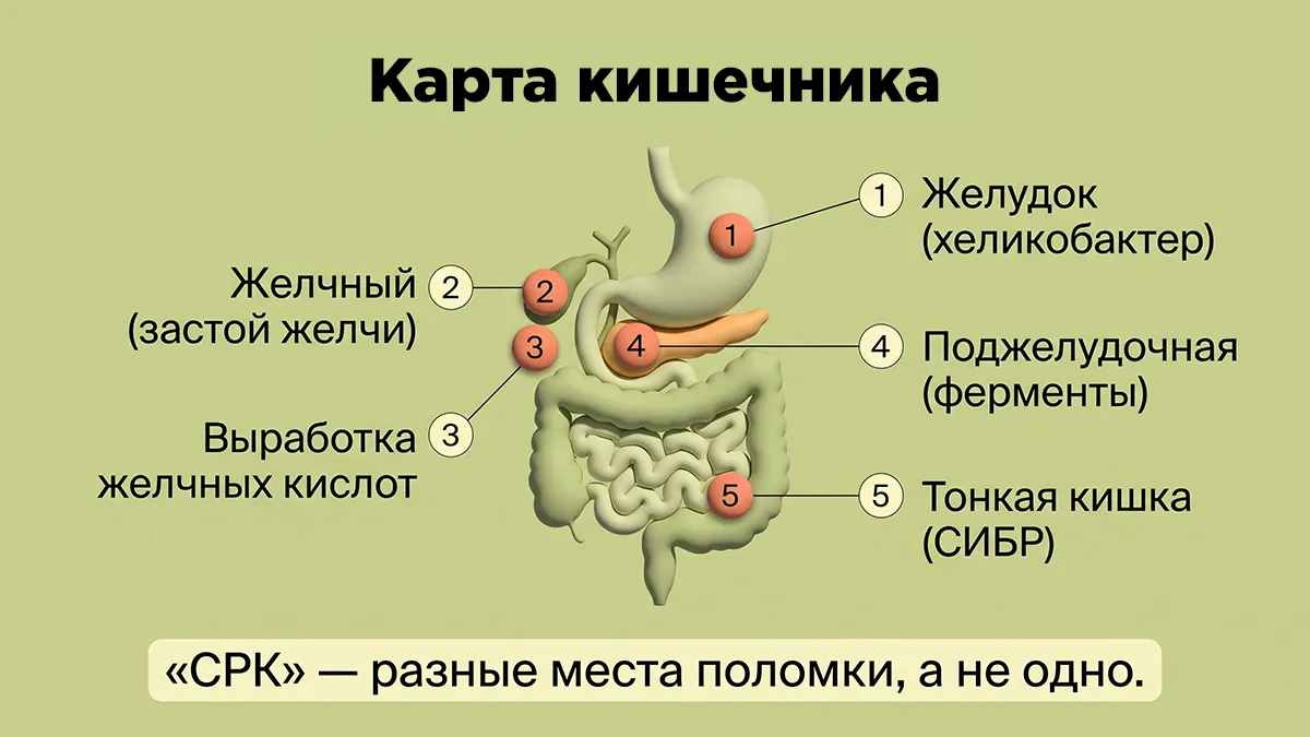 Карта кишечника: 5 точек сбоя за СРК
